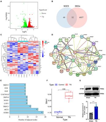 Novel insights into STIM1's role in store-operated calcium entry and its implications for T-cell mediated inflammation in trigeminal neuralgia